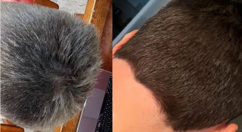 Photo showing Antal's white hair reversal