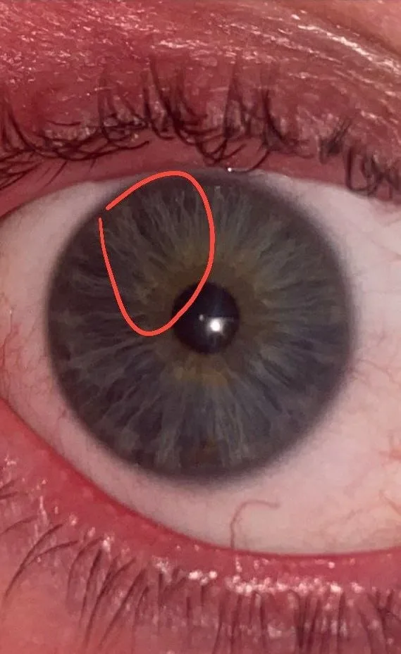 Close-up iris photograph from an anonymous person with a circled right communication-center area