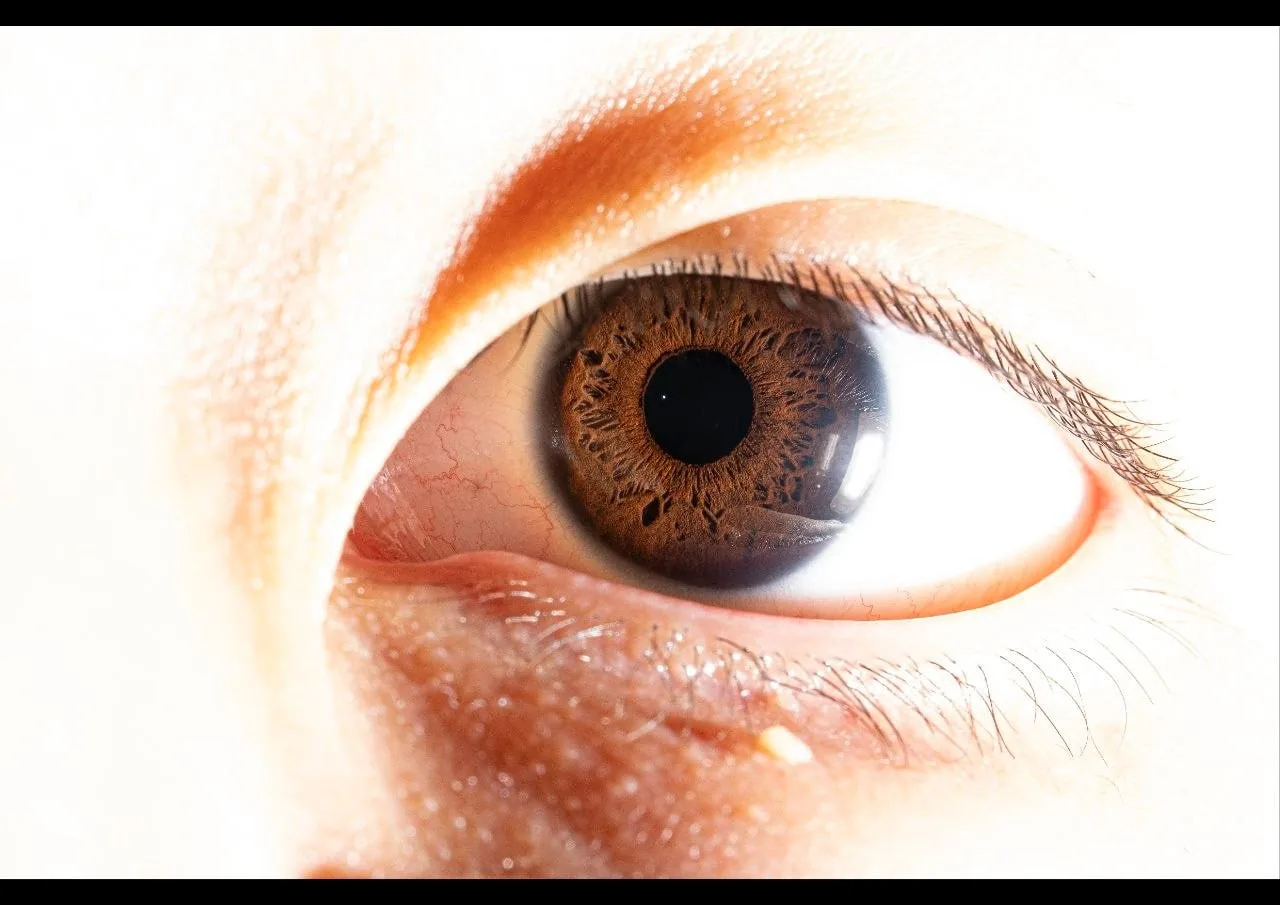 Eye photograph used for a left shoulder and neck dead area matching a small neck tumour example